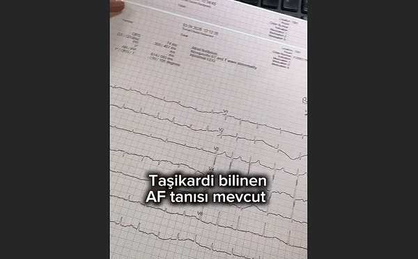 Vakaların bazıları sadece isimleriyle bile korkuttu. Peki neymiş bu vakalar?