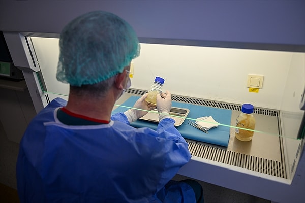 "Vefat etmiş hastalardan derinin tamamını almıyoruz"