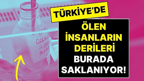 Ölen İnsanların Derileri Türkiye’de Bu Merkezde Saklanıyor, İhtiyaca Göre İşlenip Kullanılıyor!