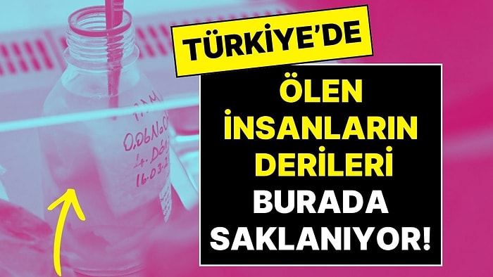 Ölen İnsanların Derileri Türkiye’de Bu Merkezde Saklanıyor, İhtiyaca Göre İşlenip Kullanılıyor!