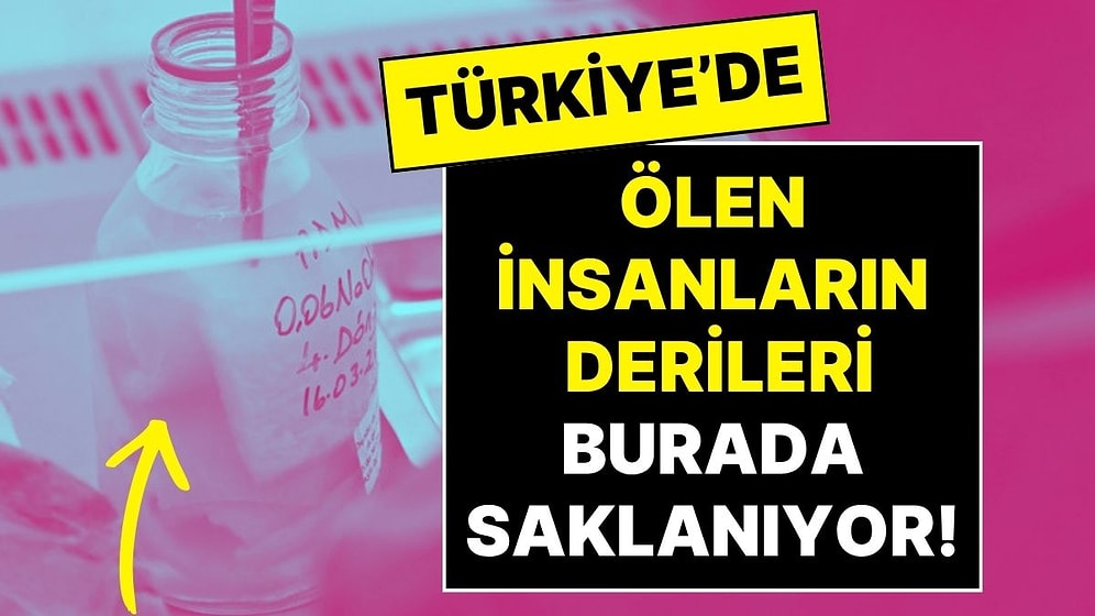 Ölen İnsanların Derileri Türkiye’de Bu Merkezde Saklanıyor, İhtiyaca Göre İşlenip Kullanılıyor!