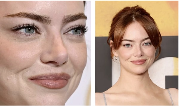 Sosyal medyanın güzellik algısı bir kez daha sorgulandı.