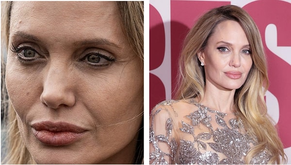 Her zaman pürüzsüz görünen ciltlerin aslında ne kadar “gerçek” olduğunu gözler önüne seren kareler, kullanıcıları şaşırtırken bir yandan da hayran bıraktı.