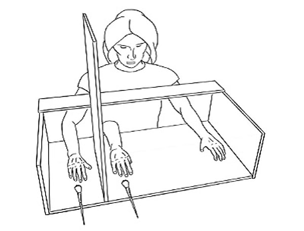 Phantom Limb Sendromu ve Tedavi Uygulamaları