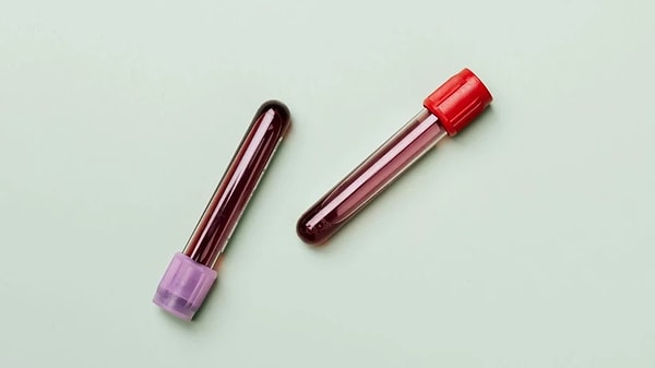 Bilimsel dayanağı yok ama bu yorumlara inanılıyor.