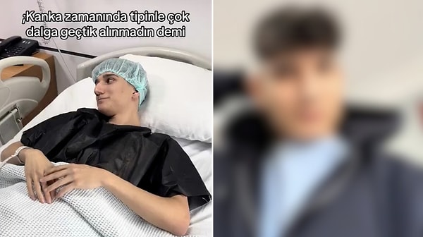 He Silenced the Critics! Teen Shares Incredible Glow-Up After Getting a Nose Job