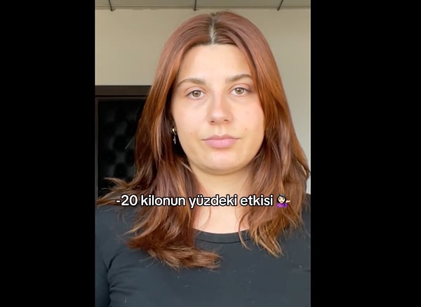 Peki yüz ve gıdıdaki yağlar sadece kilo ile ilgili mi?