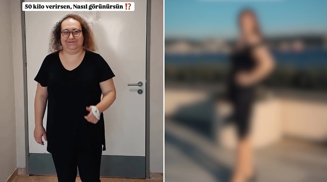 You Won’t Believe It’s the Same Person! See This Woman’s Stunning Weight Loss Before and After Results