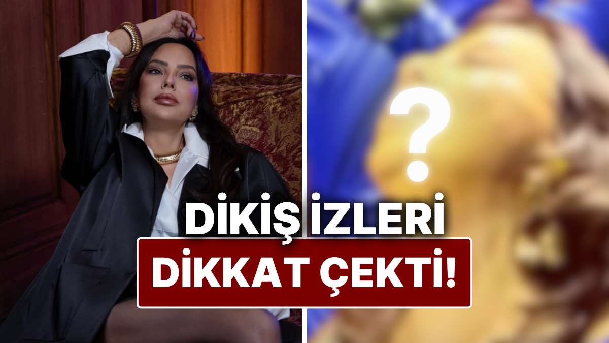 Ebru Gündeş'in Yarım Yüz Gerdirme Ameliyatı Sonrası Yüzündeki Dikiş İzleri Dikkat Çekti