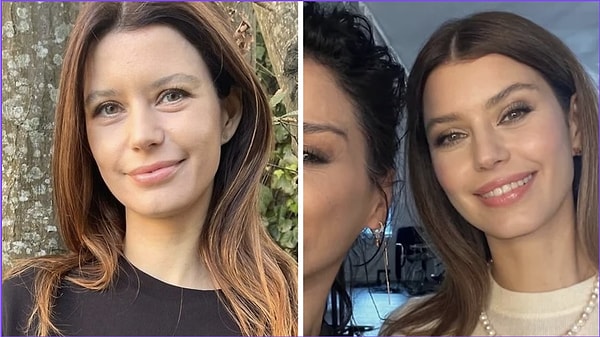 Beren Saat has emerged as a standout figure from the early years of her career, captivating attention with both her acting prowess and natural beauty.