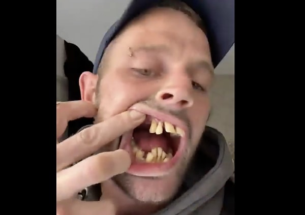 So, what makes Turkey stand out in dental tourism?