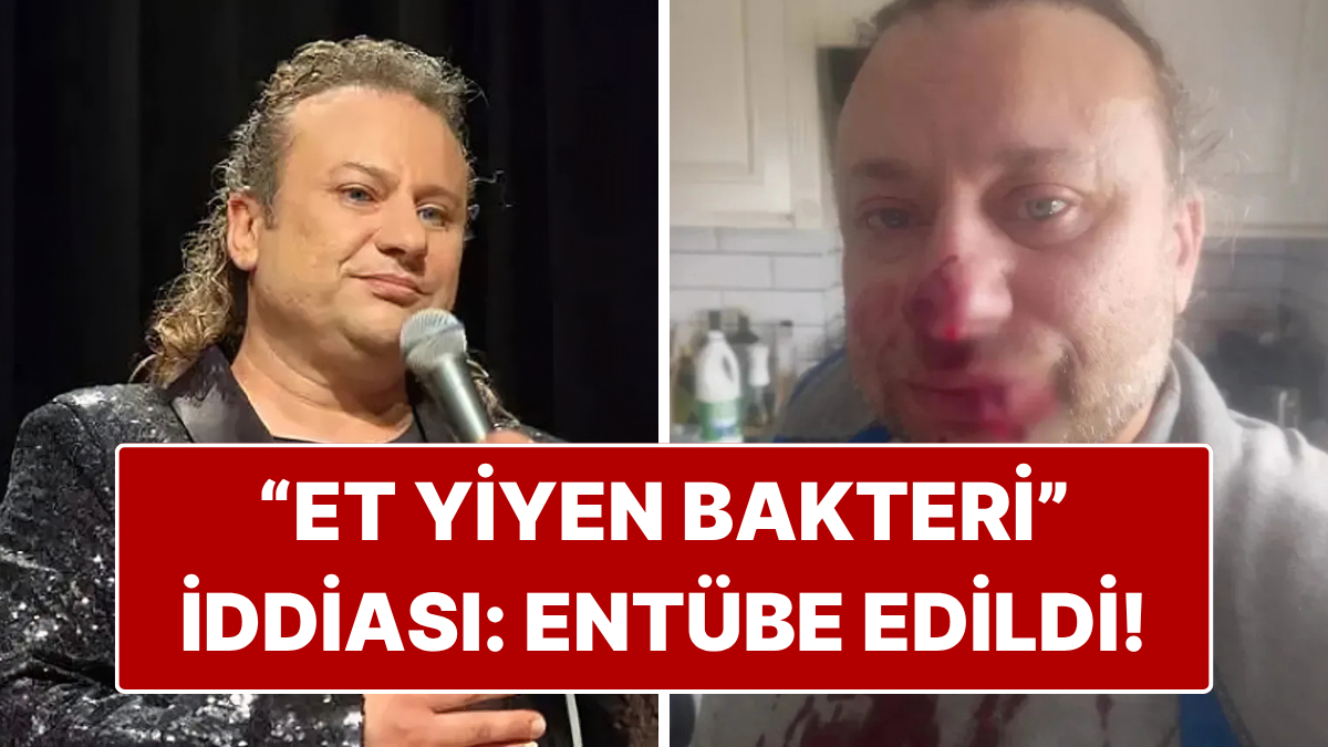 Köpek Saldırısına Uğrayan Onur Akay Entübe Edildi!
