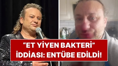 Köpek Saldırısına Uğrayan Onur Akay Entübe Edildi!