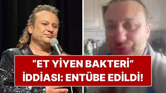 Köpek Saldırısına Uğrayan Onur Akay Entübe Edildi!