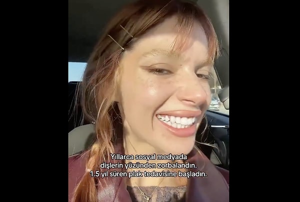 Peki plak tedavisi nasıl işliyor?