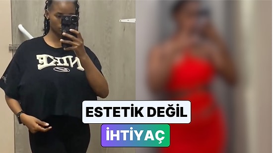 Gigantomastisi Olan Bir Kadın Meme Küçültme Operasyonundan Önceki ve Sonraki Halini Paylaştı