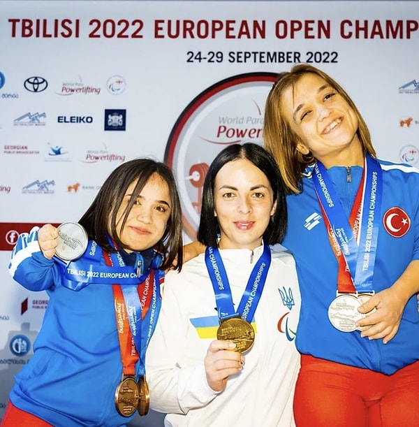 Türkiye’de paralimpik sporculara bakış açısını nasıl değerlendiriyorsun?