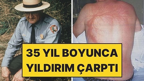 35 Yıl Boyunca Tekrar Tekrar Yıldırım Çarptı