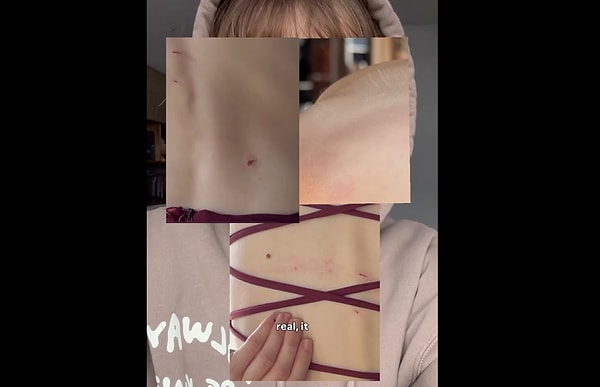 Hem ortaya çıkan sonucu hem aldığı yaraları paylaştı.