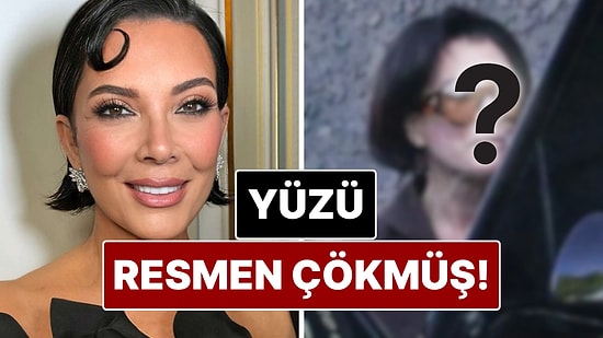 Estetik Operasyon Sonrası Kris Jenner'ın Yüzü Resmen Çöktü!