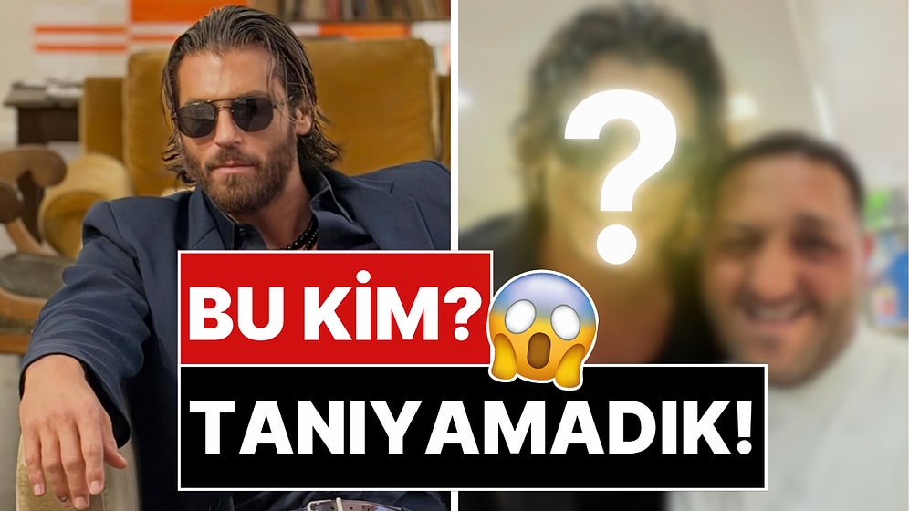 Radikal İmaj Değişikliğine Giden Can Yaman'ın Son Hali Şoklardan Şoklara Soktu!