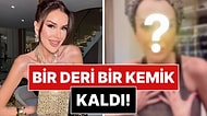 Bir Deri Bir Kemik Kalan Dilan Polat'ın Son Hali Endişelendirdi!