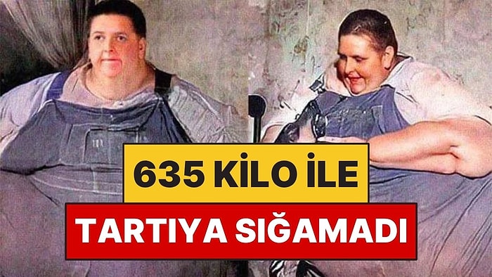 635 Kilo ile Hastanede Savaş Verdi: Tartıya Sığamadı