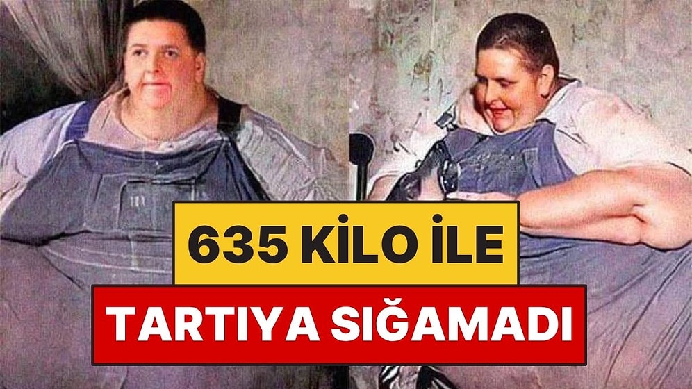 635 Kilo ile Hastanede Savaş Verdi: Tartıya Sığamadı