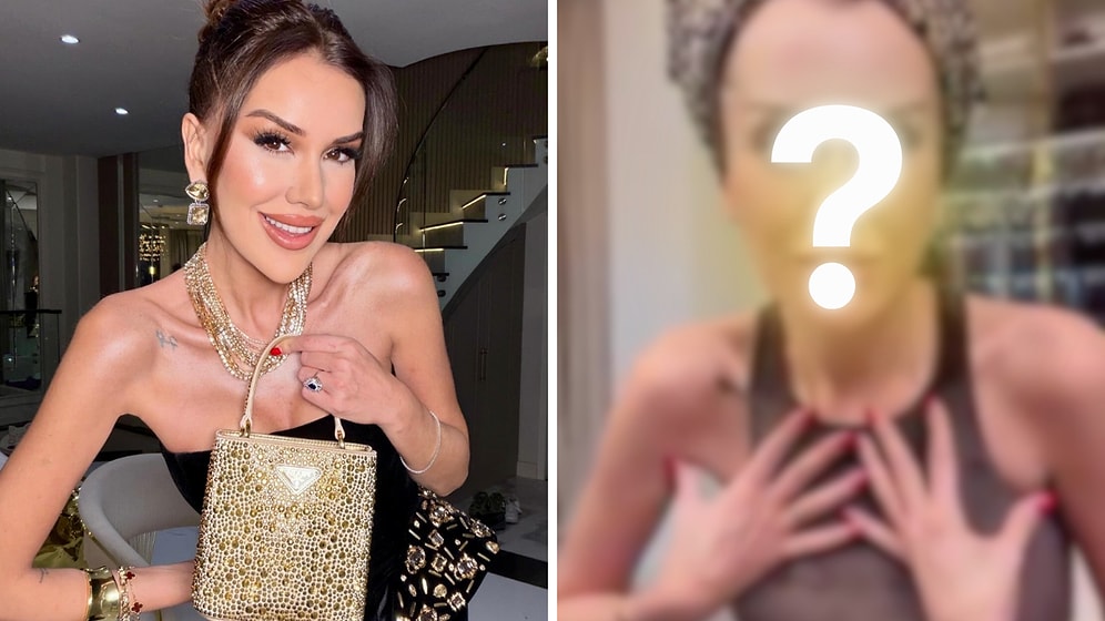 Dilan Polat’s Drastic Weight Loss Sparks Concern