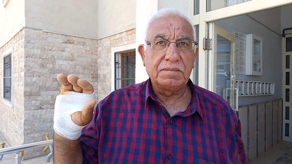 "Bir husumetimiz yoktu. Elimi ısırınca parmağımı koparana kadar bırakmadı."