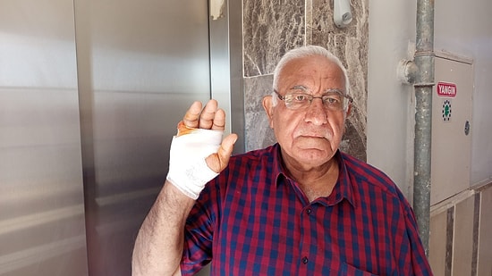 No Prior Hostility: Man Bites off and Severs Neighbor's Finger During Unexpected Fight