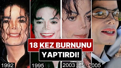 Burnundan 18 Operasyon Geçirdiği İddia Edilen Michael Jackson’ın Yıllar İçindeki Değişimini İnceliyoruz!