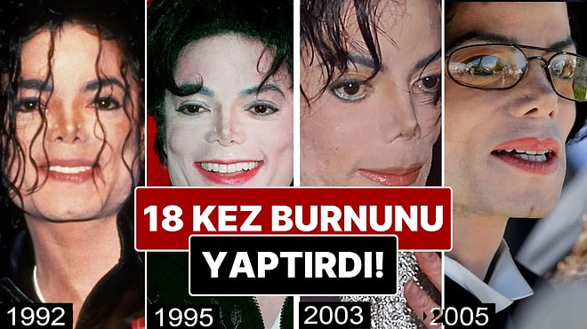 Burnundan 18 Operasyon Geçirdiği İddia Edilen Michael Jackson’ın Yıllar İçindeki Değişimini İnceliyoruz!