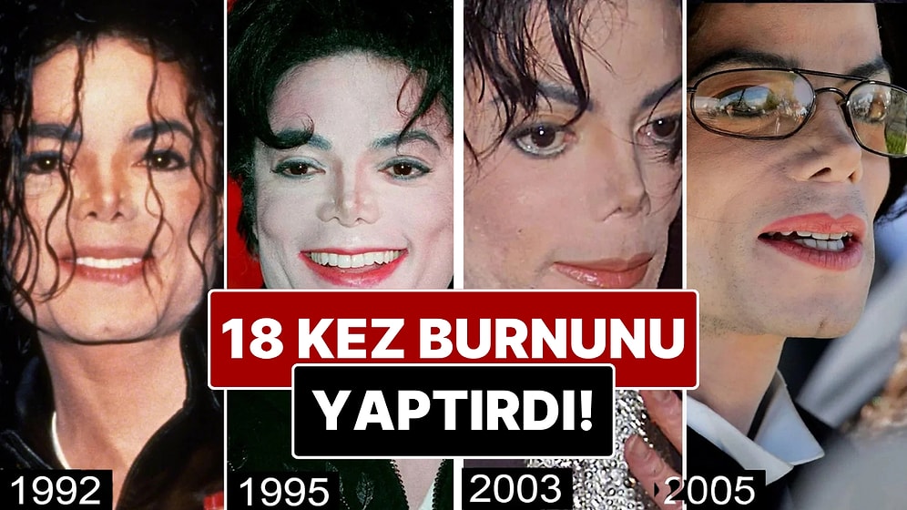 Burnundan 18 Operasyon Geçirdiği İddia Edilen Michael Jackson’ın Yıllar İçindeki Değişimini İnceliyoruz!