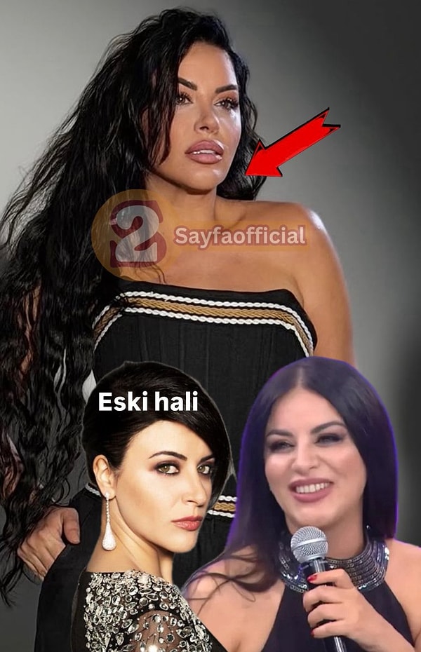 20 Kilo Vermişti: Bambaşka Biri Olan Zara’nın Yıllar İçindeki Değişimi Gündem Oldu!