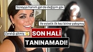 20 Kilo Vermişti: Bambaşka Biri Olan Zara’nın Yıllar İçindeki Değişimi Gündem Oldu!