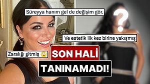 20 Kilo Vermişti: Bambaşka Biri Olan Zara’nın Yıllar İçindeki Değişimi Gündem Oldu!