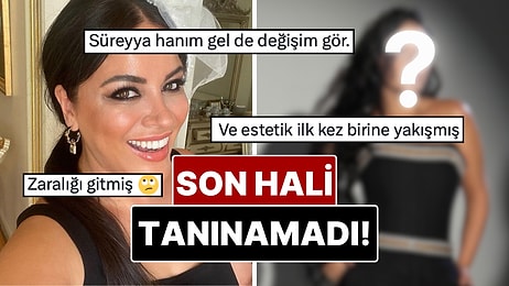 20 Kilo Vermişti: Bambaşka Biri Olan Zara’nın Yıllar İçindeki Değişimi Gündem Oldu!