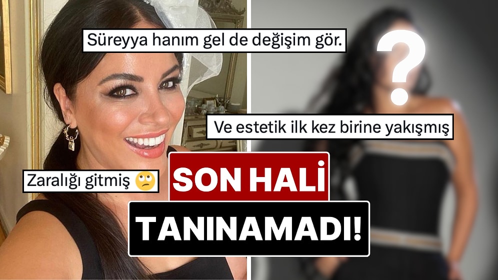 20 Kilo Vermişti: Bambaşka Biri Olan Zara’nın Yıllar İçindeki Değişimi Gündem Oldu!