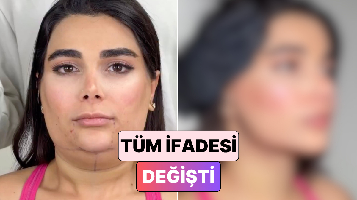 Bir Kadının Gıdı ve Yüz Germe Ameliyatından Sonraki Değişimi Beğeni Topladı