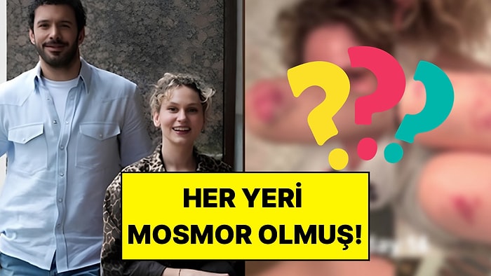 Soy Filminin Çekimlerine Başlamıştı: Farah Zeynep Abdullah Vücudundaki Morlukları Paylaştı