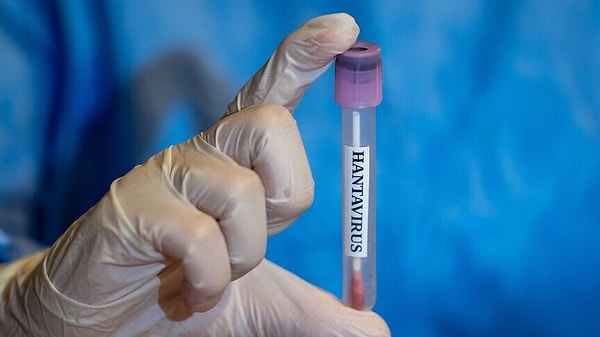 A definitive answer to the question, "Is there a risk of an outbreak?"