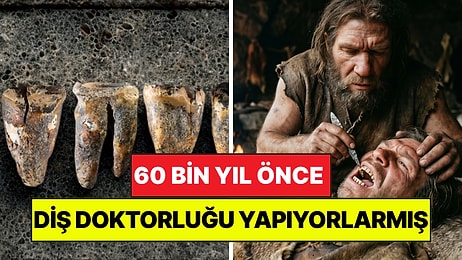 60 Bin Yıl Önce Diş Doktorluğu Yapıyorlarmış: Neandertaller Diş Çürüğünü Taşla Tedavi Etmiş