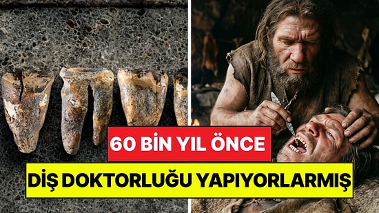60 Bin Yıl Önce Diş Doktorluğu Yapıyorlarmış: Neandertaller Diş Çürüğünü Taşla Tedavi Etmiş