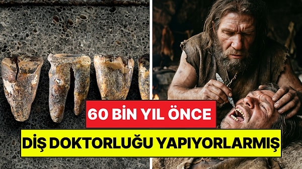 60 Bin Yıl Önce Diş Doktorluğu Yapıyorlarmış: Neandertaller Diş Çürüğünü Taşla Tedavi Etmiş
