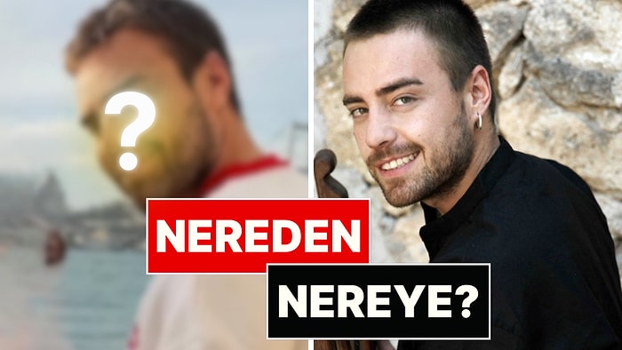13 Kez Burun Ameliyatı Geçiren Murat Dalkılıç'ın Son Hali Kimsenin İçine Sinmedi
