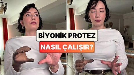 Biyonik Protez Kol Kullanan İçerik Üreticisi Protezinin Nasıl Çalıştığını Gösterdi