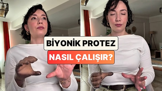 Biyonik Protez Kol Kullanan İçerik Üreticisi Protezinin Nasıl Çalıştığını Gösterdi