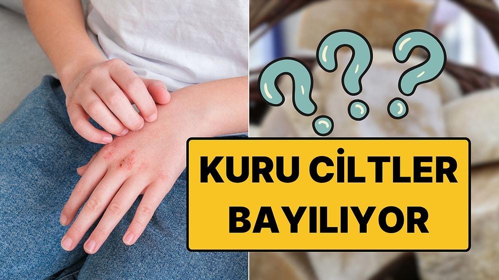 Egzamanın Kökünü Kurutan Doğal Yöntem: Kuru Ciltler Bayılıyor!