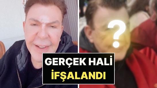 Yüz Gerdirme Ameliyatı Olan Kuşum Aydın'ın Filtresiz "Gerçek" Hali Ortaya Çıktı!